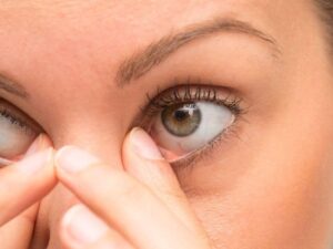علاج التهاب العين