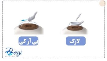 تفاوت عمل لازک با پی آرکی در چیست؟