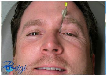 The-importance-of-care-after-tear-duct-surgery اهمیت مراقبت بعد از عمل مجرای اشک
