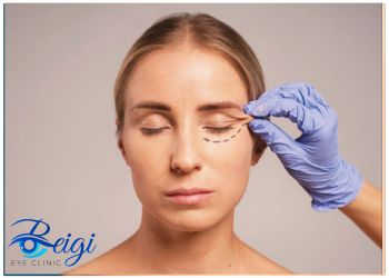 Benefits-of-fat-transfer-in-lower-eyelid-blepharoplasty فواید جا به جا چربی در بلفاروپلاستی پلک پایین