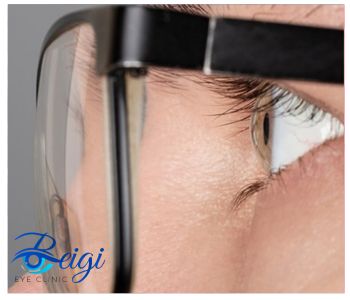 Eye-diseases-for-military-exemption بیماری های چشمی برای معافیت سربازی