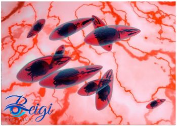 Prevention-of-ocular-toxoplasmosis پیشگیری از توکسوپلاسموز چشمی