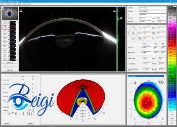 Applications-of-eye-and-cornea-pentacam کاربردهای پنتاکم چشم و قرنیه