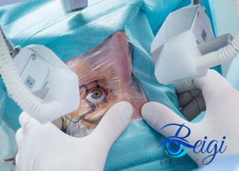 Candidates-for-cataract-surgery افراد کاندیدای انجام عمل آب مروارید