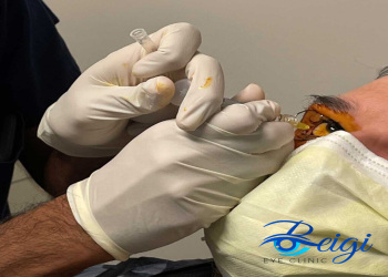 How-to-perform-intraocular-injection روش انجام تزریق داخل چشمی